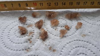 20190104_121551-min.thumb.jpg.4bd16e8a6768f8ec7193e53ba84a4a21.jpg